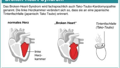 Broken Heart Syndrome