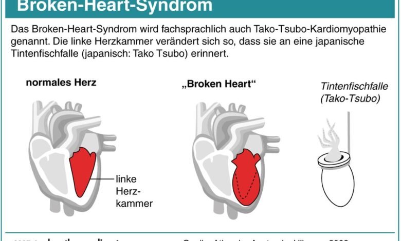 Broken Heart Syndrome